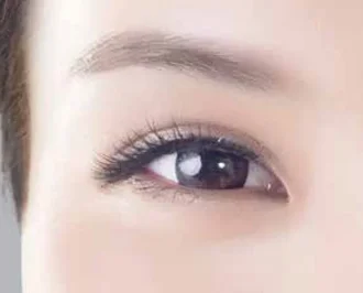 Close-up of a woman's eye and brow for Ultherapy skin lifting in London