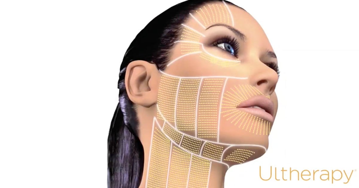 Ultherapy treatment map of the face and neck at Ultherapy London, 8 Devonshire Place, Harley Street medical district